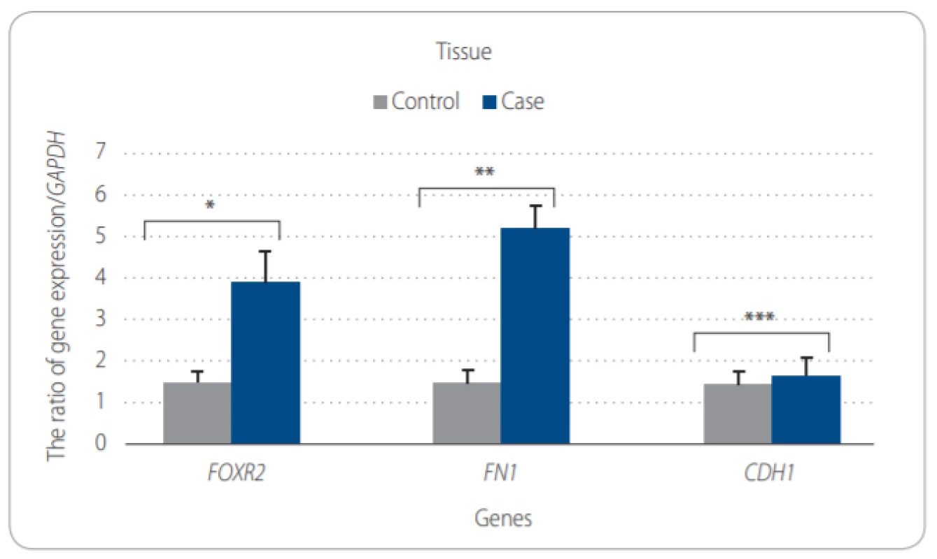 A. Comparison of expression of target genes to GAPDH in epithelial ovarian tissues (EOC) obtained from EOC patients and SKOV-3 cell line by Mann-Whitney test. The
ratio of genes expression of FOXR2, FN1, CDH1 and GAPDH.