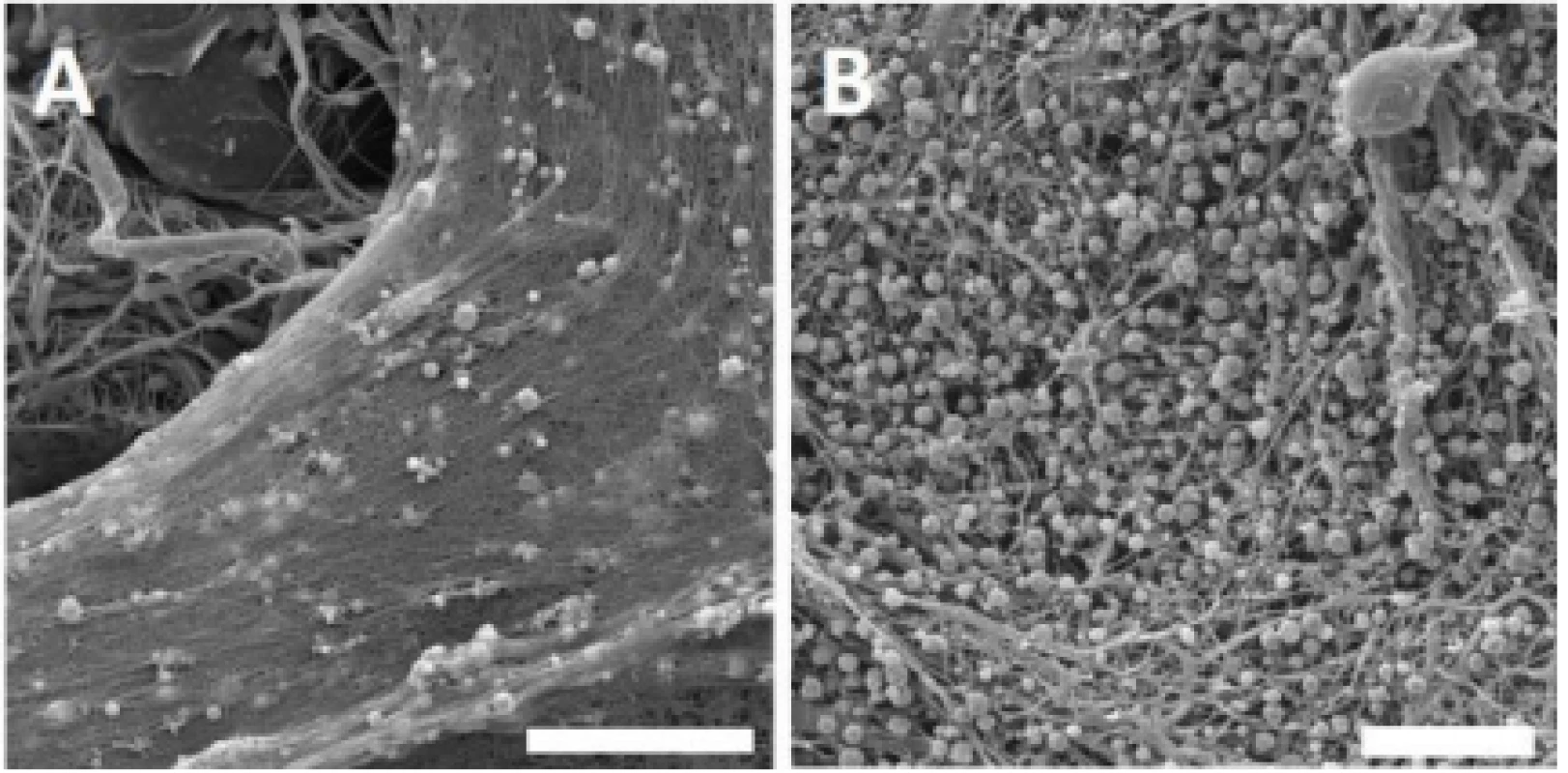  Scanning electron microscopy images of the
PCL samples functionalized with platelets. Images for
PVA not shown; no fibrin network was detected.
A – PCL with platelets and fibrin network, day 1.
Magnification 4,000×; scale bar 20 µm. B – PCL with
platelets and fibrin network residua, day 8. Magnification 3,000×; scale bar 20 µm.