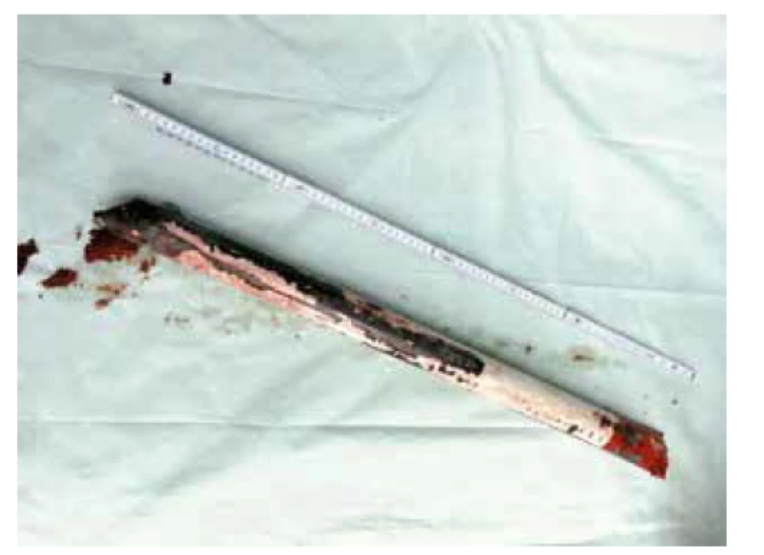 Trubka<br>
Fig. 10: The tube