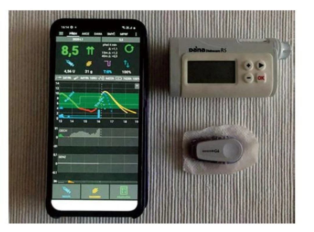 Automatický systém AndroidAPS testovaný jako „zcela
uzavřená smyčka“ skládající se z telefonu s algoritmem
umělé slinivky, CGM a inzulinové pumpy
