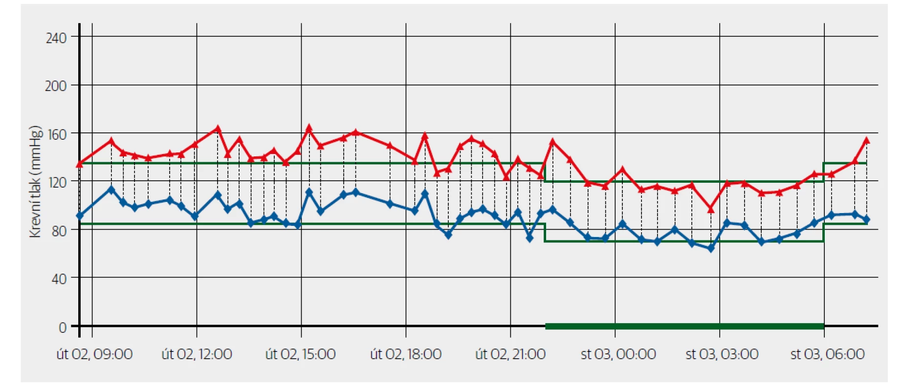 Příklad 24hodinové monitorace krevního tlaku. Vyšetření bez antihypertenzní terapie. Průměrný krevní tlak za 24 hodin byl 136/90 mmHg, ve dne
145/96 mmHg, v noci 119/78 mmHg. SF za 24 hodin 64/min, ve dne 71/min a v noci 51/min. Záznam potvrzuje systolicko-diastolickou hypertenzi zejména
v aktivní fázi dne s výrazným nočním poklesem (dipper 17 %). Příznivá hodnota krevního tlaku na začátku měření ukazuje na obraz možné maskované
hypertenze.
Doporučeno zahájení antihypertenzní terapie.