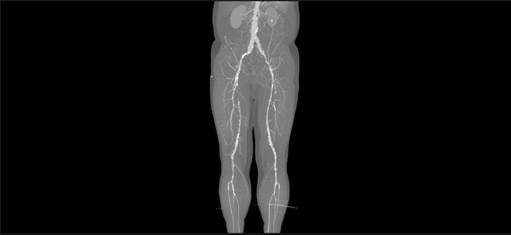 CT angiografie – rekonstrukce obrazu<br>
Fig. 1: CT angiography – image reconstruction
