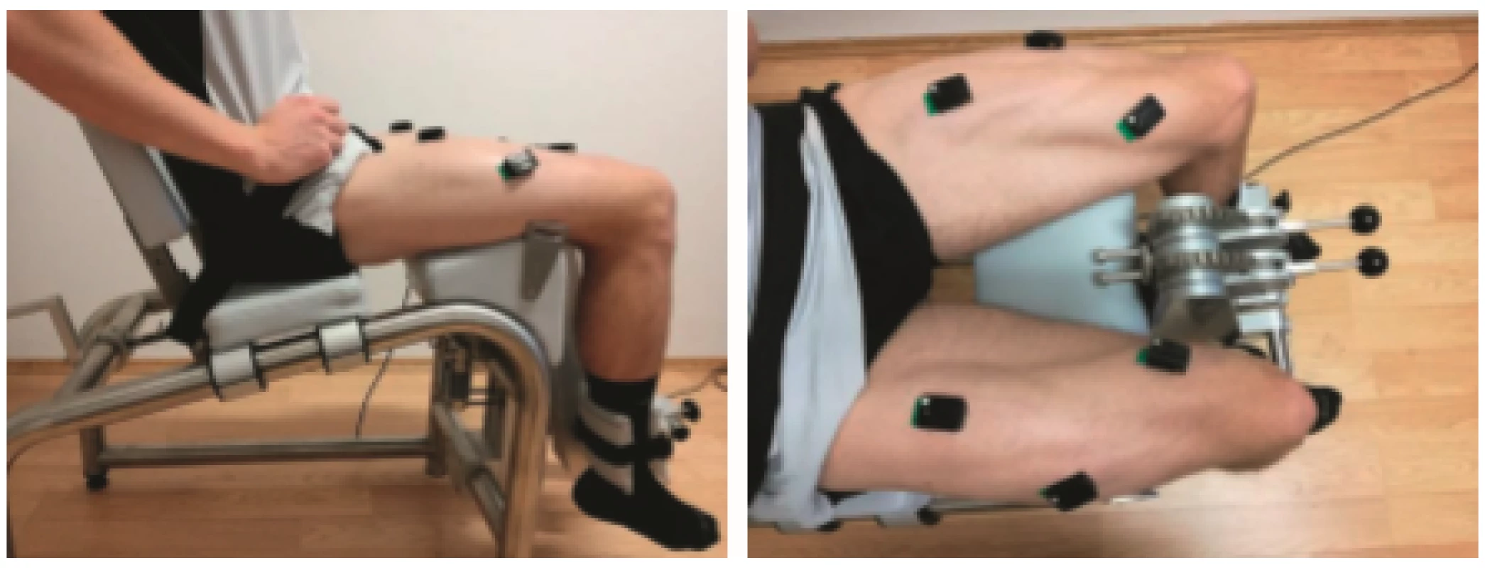 Testovanie EMG aktivity m. rectus femoris, m. vastus medialis, m. vastus lateralis pri teste maximálnej izometrickej sily extenzorov kolenného kĺbu.