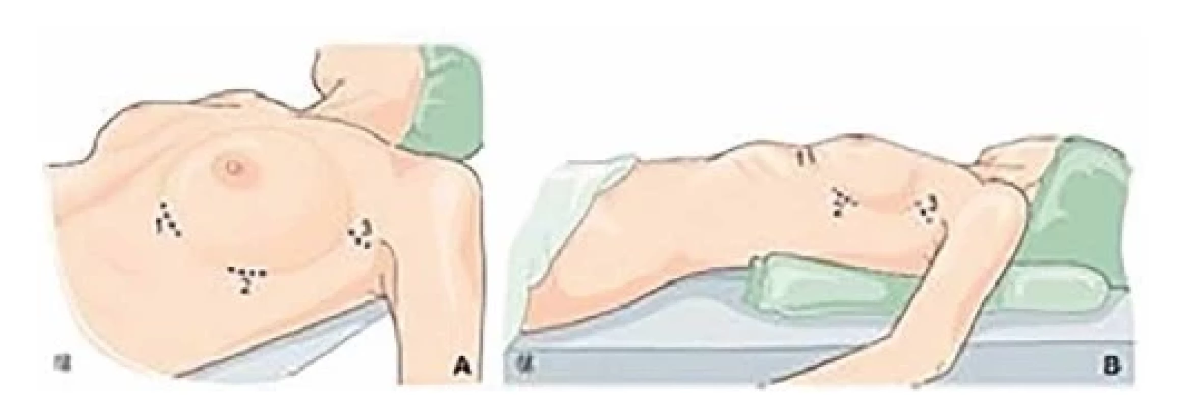 Poloha pacienta<br>
Fig. 4: Patient position