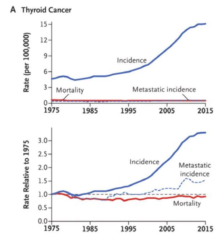 Vývoj incidence a mortality zhoubných nádorů štítné žlázy v letech
1975–2015. Upraveno podle Welsch et al. 2019 (3)