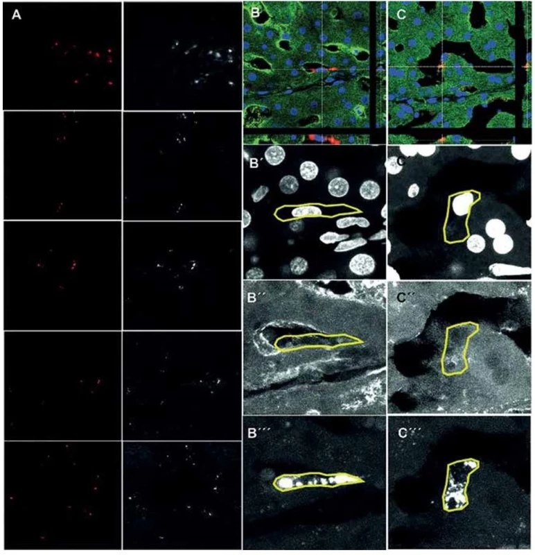 Tracked mesenchymal stem cells in the liver 21 days
after transplantation detected by confocal microscopy<br>
Fluorescent detection of tracked mesenchymal stem cells (A,
red, 400x magnification) in different liver lobes. Co-localization
analysis of tracked MSCs (red) with pig specific albumin
(green) in liver parenchyma (B, C, 630x magnification). B´, C´
– DAPI; B´´, C´´– pig albumin; B´´´, C´´´– CM-DiI.