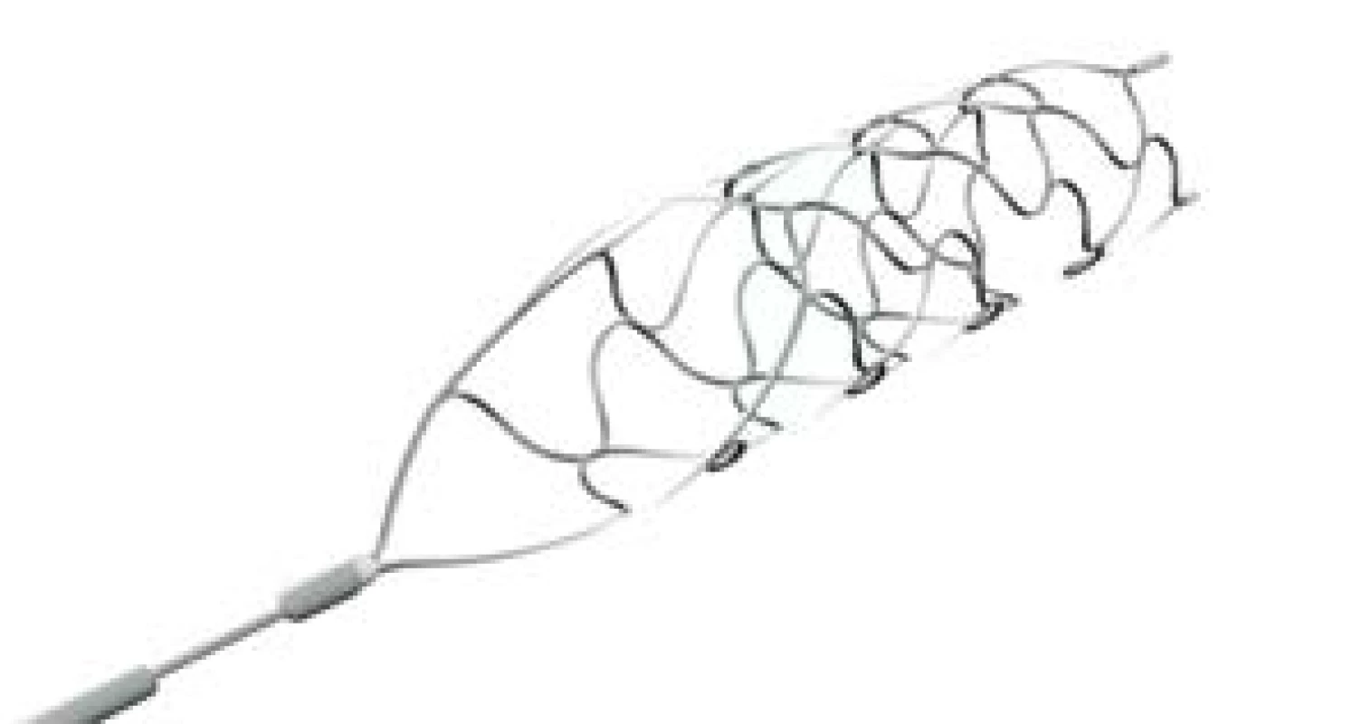 Stent-retriever pREset
