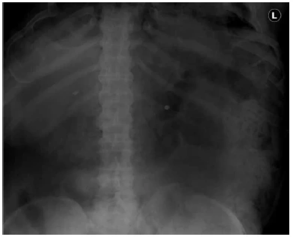 Fig. 3.
