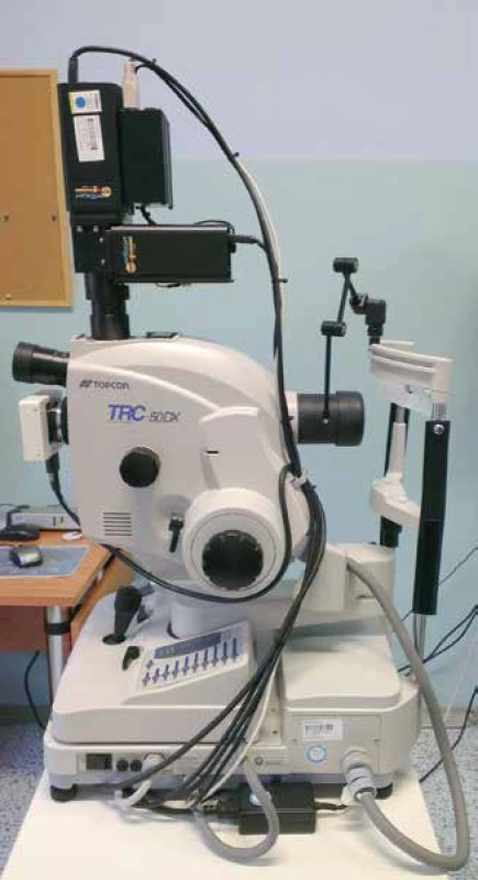 Retinální oxymetr Oxymap T1 (černý přístroj
nahoře) umístěný na sítnicové kameře Topcon