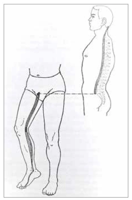 Šľachovo-svalová dráha
obličiek<br>
Fig. 15. Tendon-muscle path of the
kidney