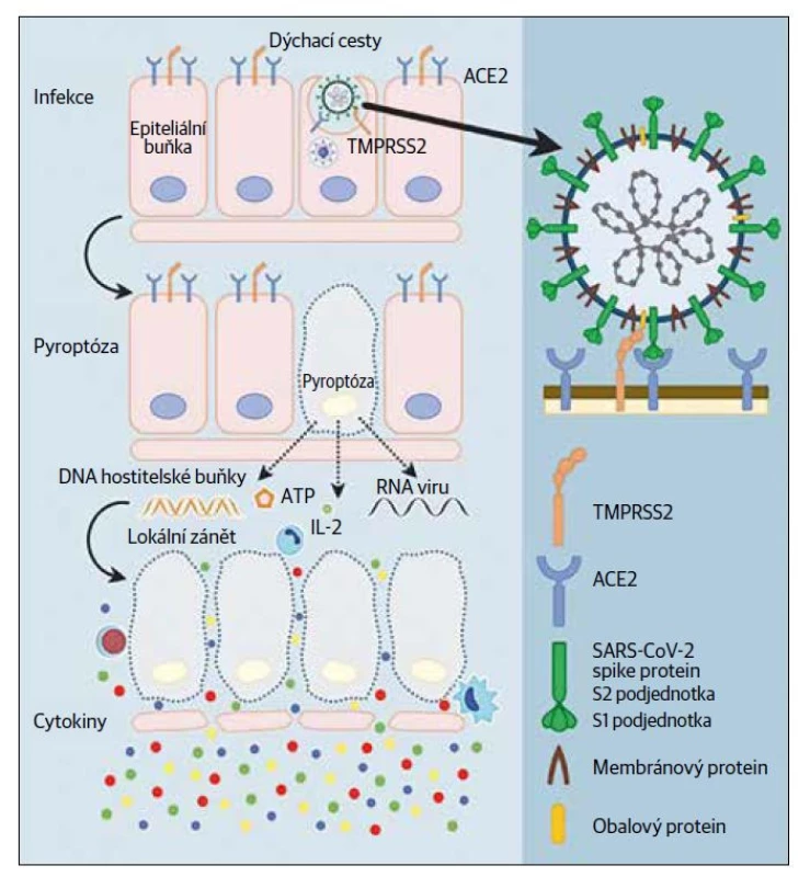 Části koronaviru a vazba na buňku, pyroptóza (inspirováno schématem: Jiang L, Tang K,
Levin M, Irfan O, Morris SK, Wilson K, Klein JD, Bhutta ZA. COVID-19 and multisystem inflammatory
syndrome in children and adolescents. Lancet Infect Dis 2020;20(11):e276–e288).
