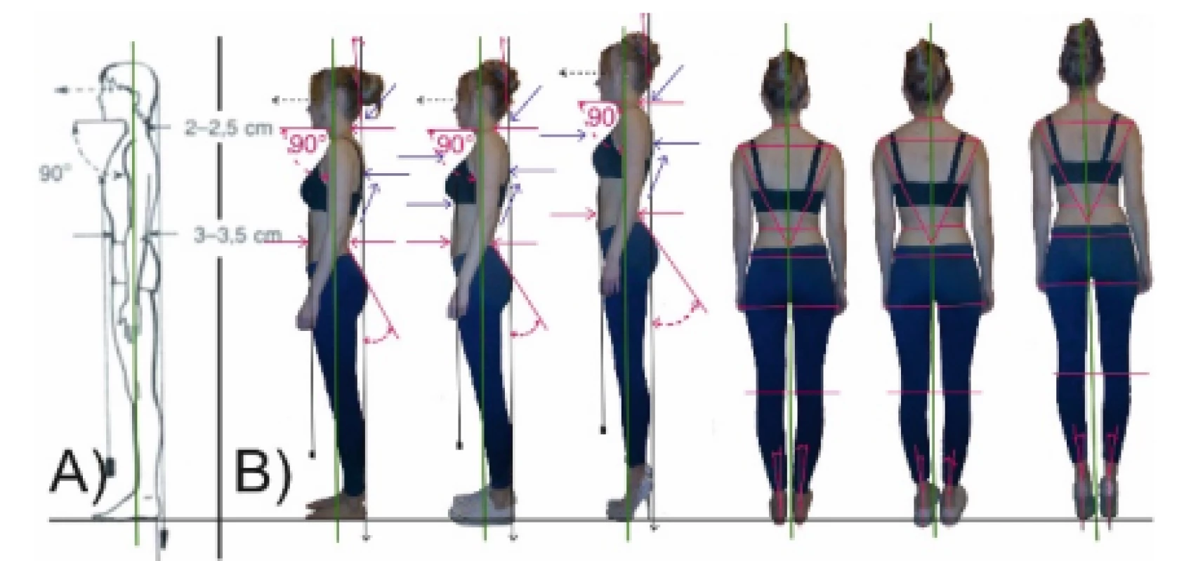 Standing-body alignment A) Lateral View-Good
posture. B) Lateral View and Posterior View Posture.