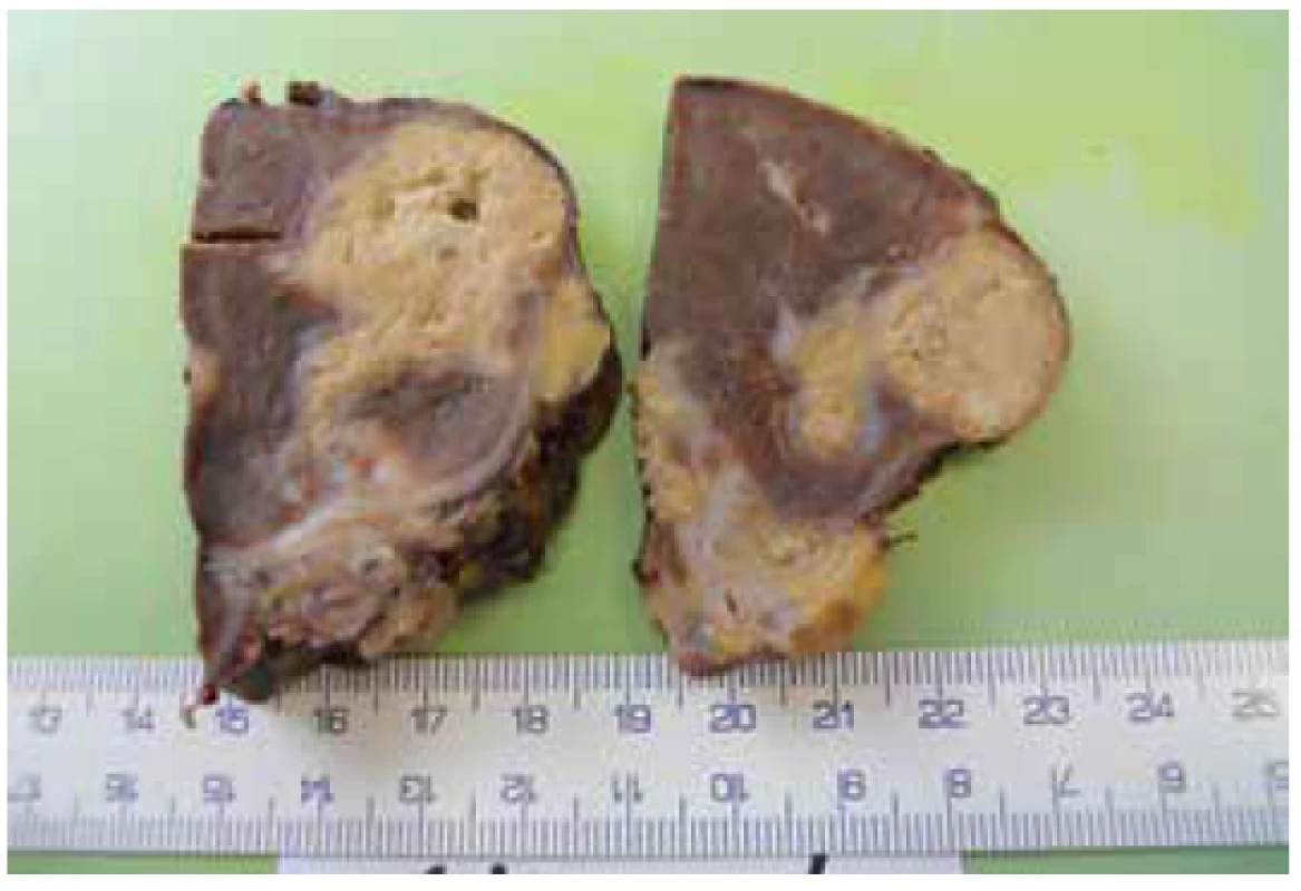 Histologický preparát – makrofotografie řezu slezinou<br>
Fig. 1. Histological sample – magnified photo of a splenic
tissue section