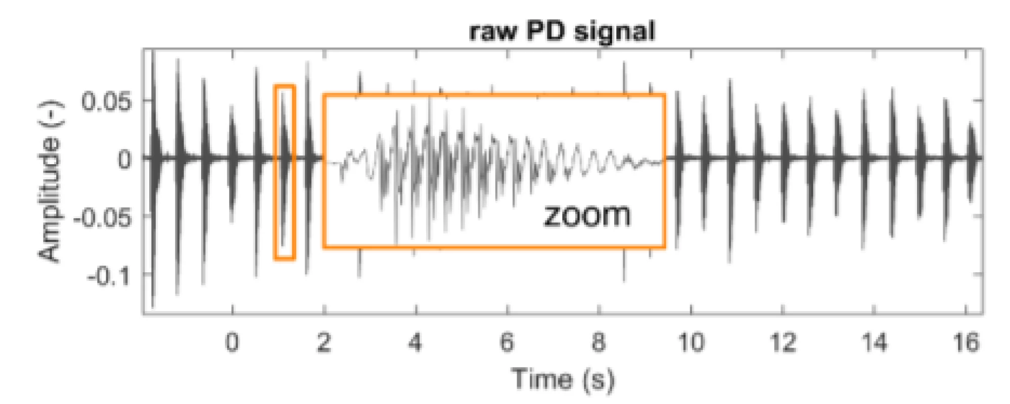 An example of a typical raw speech signal from
a patient with PD. During the recording, the subject
repeated the syllable /pa/ rhythmically.