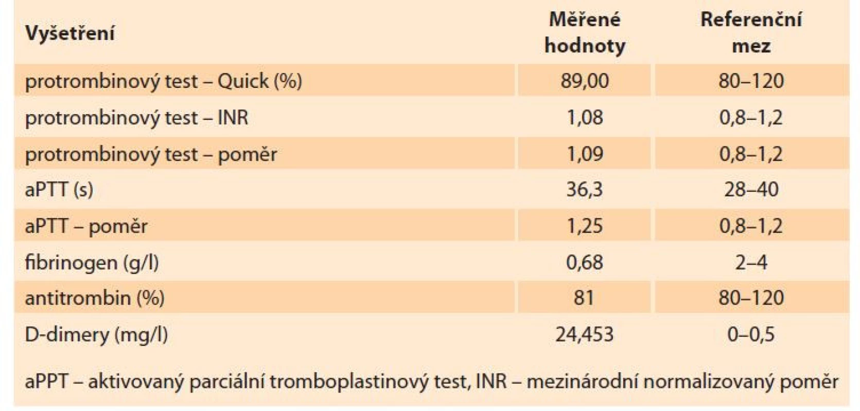Laboratorní nálezy – koagulace.<br>
Tab. 2. Laboratory findings – coagulation.