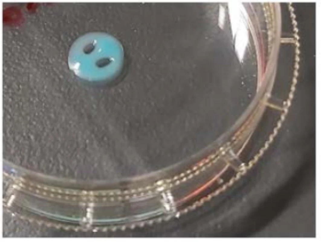3D printed sensor hydrogel on Ar plasma
activated Petri dish.