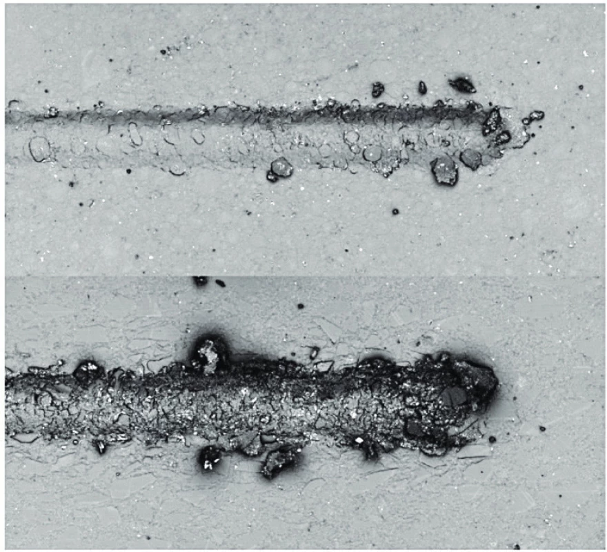 CLSM obraz vrypů flow kompozitního (nahoře) a pastovitého
nanohybridního kompozitního materiálu (dole)