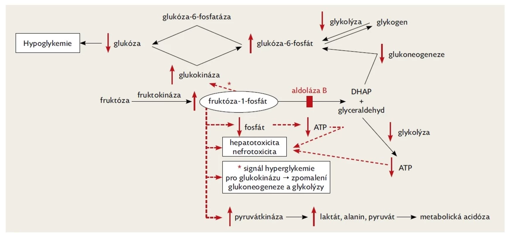 Schematické znázornění patofyziologie hereditární fruktózové intolerance