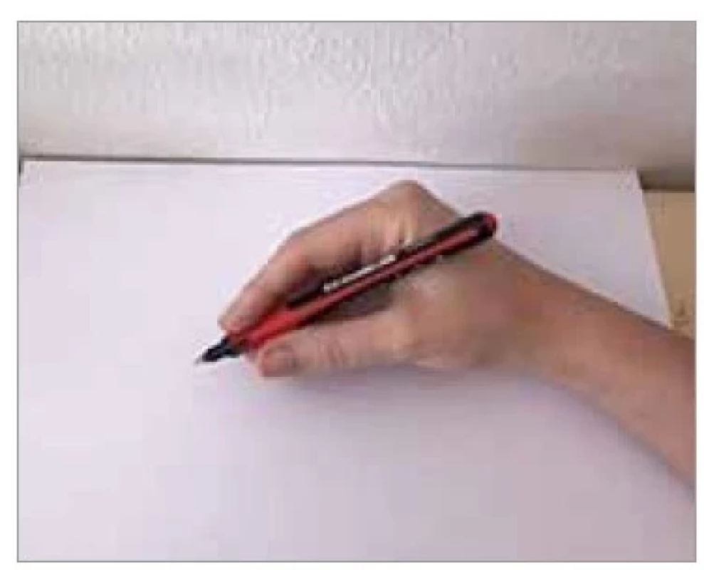 Standardní tužkový/špetkový
úchop.<br>
Fig. 1. Standard pencil grip.