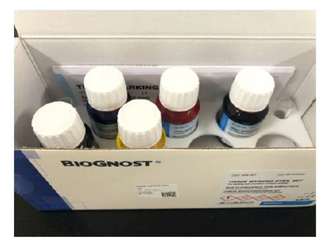 Sada barev k značení preparátu<br>
Fig. 2. Set of colours for marking the tissue