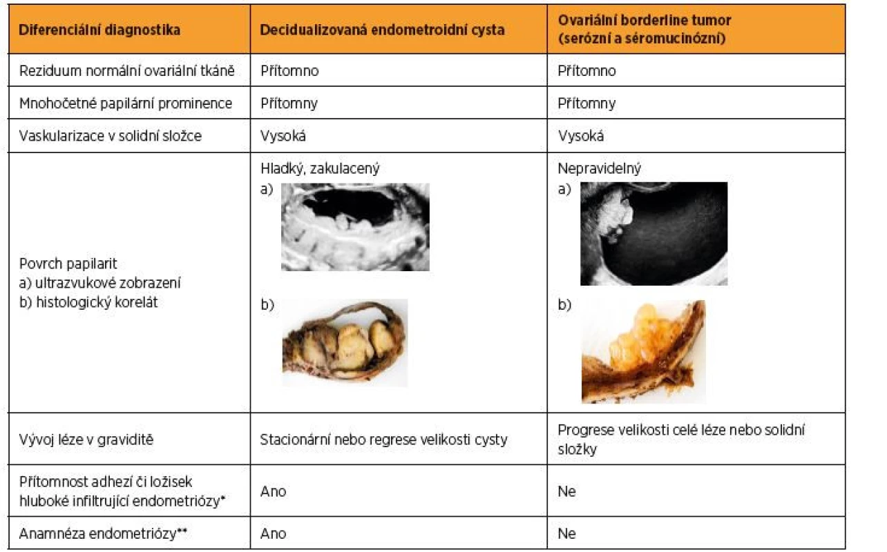 Charakteristiky odlišující u těhotných žen decidualizované endometroidní cysty od ovariálních borderline tumorů