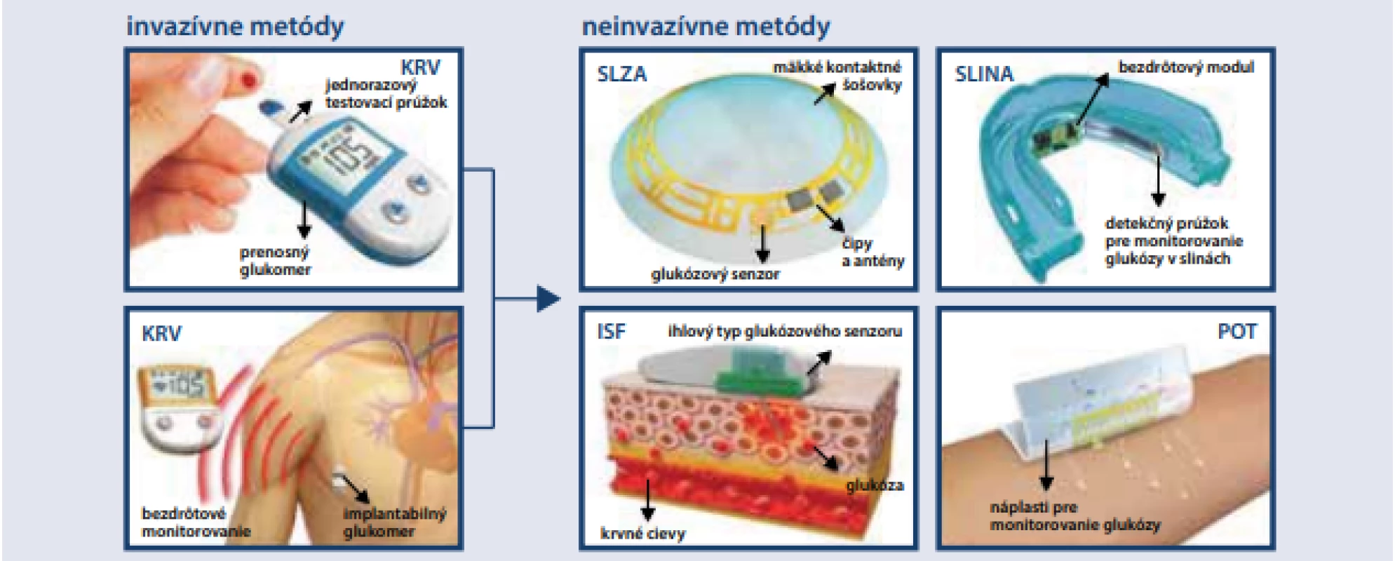 Vývoj elektrochemických senzorov na monitorovanie glukózy [12]