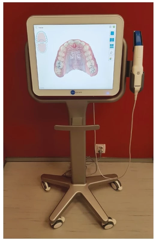 Intraorální skener
iTero Elements.<br>
Fig. 1
Intraoral scanner
iTero Elements.
