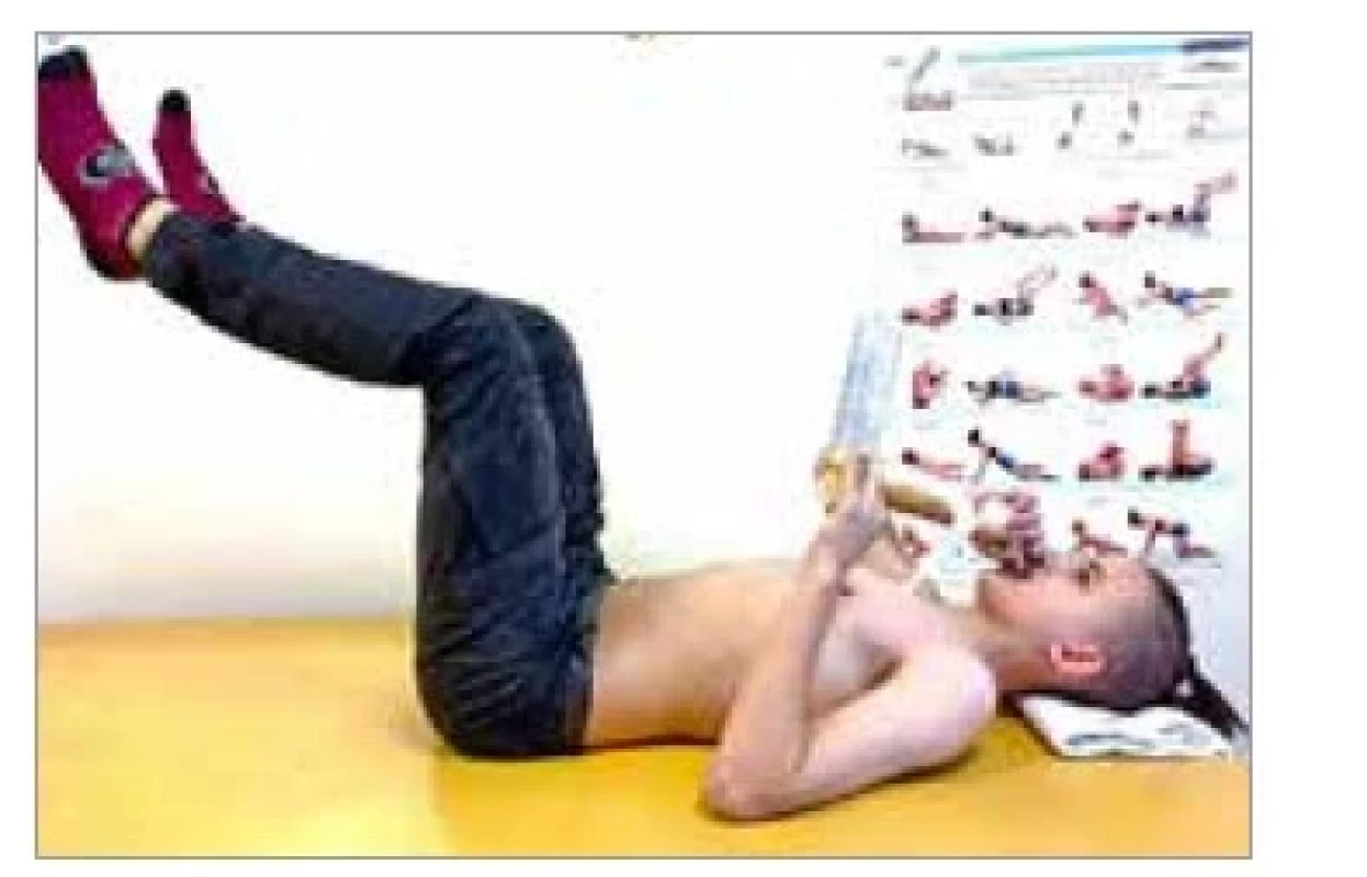 Pacient s cystickou fibrózou,
kombinace dechového a posturálního
tréninku.<br>
Fig. 5. Patient with cystic fibrosis,
combination of breathing and postural
training.