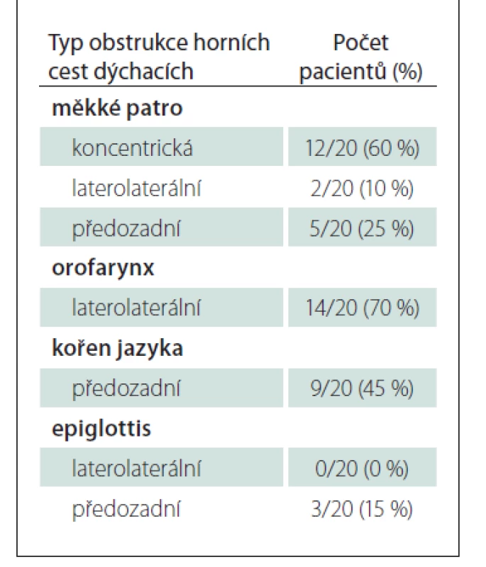 Zastoupení typů obstrukcí
horních cest dýchacích při spánkové
endoskopii.