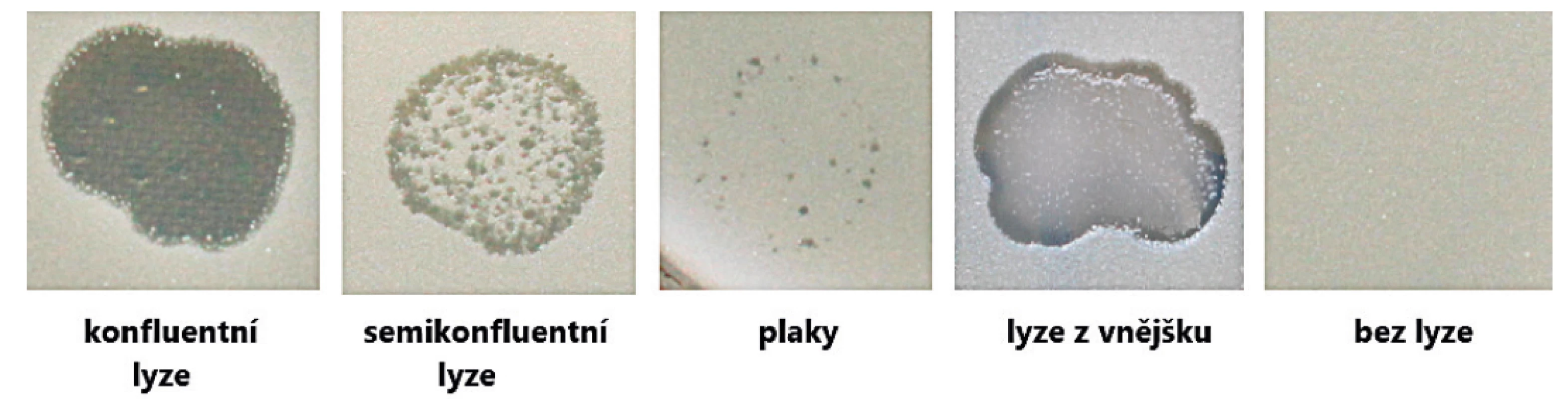 Hodnocení účinnosti Stafalu® metodou dvouvrstevného agaru<br>
Figure 1. Stafal® activity testing by the double-layer agar method