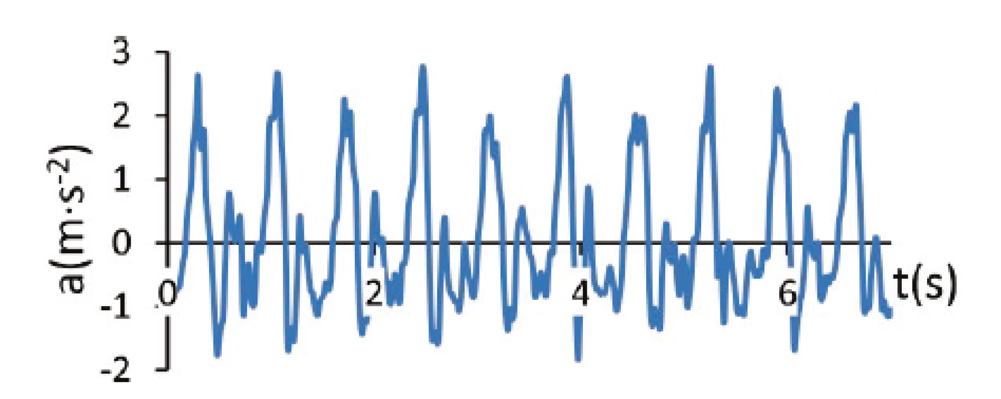Example of a visualization of the measured magnitude of the acceleration vector in time domain
data during gait. It is a record of a triple axis accelerometer located on an individual’s upper arm.