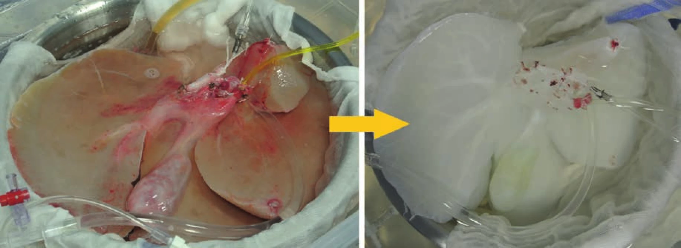 Prasečí játra před (vlevo) a po decelularizaci (vpravo)<br>
Fig. 2: Pig liver before (left) and after decellularization (right)