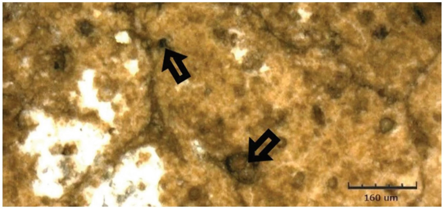 Harvard Ionoresin Fill v kyselém pH po 14 dnech, zobrazeno CLSM<br>
Fig. 4 Harvard Ionoresin Fill at acidic pH after 14 days, shown by CLSM