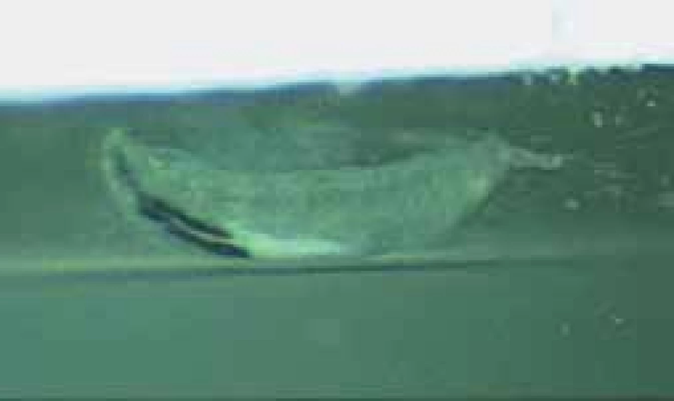 Caught individual Oestrus ovis larva in formaldehyde
photographed on slit lamp 