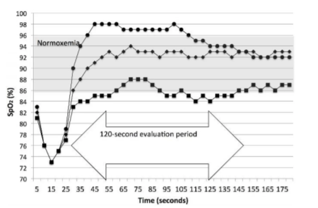  Prototypical Examples of Sustained Response.
The curve with the circles is a Sustained response
of Hyperoxemia, with an Initial response of
Normoxemia. The curve with the diamonds is
a Sustained response of Normoxemia, with an Initial
response of Normoxemia. The curve with the squares is
a Sustained response of Low-oxemia, with an Initial
response of Low-oxemia. The first and third both spend
part of the time, but less than half, in Normoxemia.