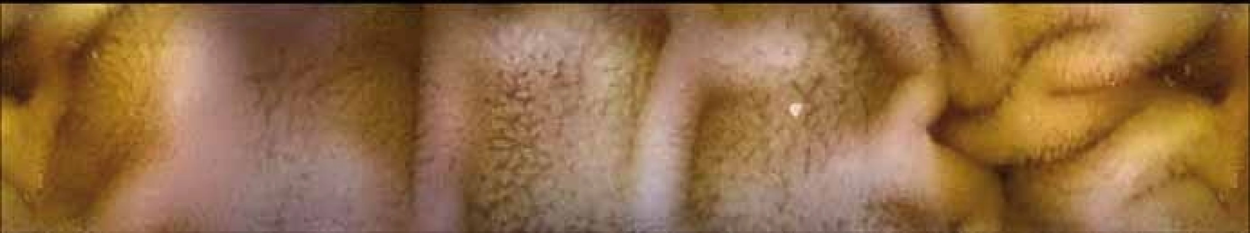 Normální endoskopický nález v jejunu, prase domácí – kapslová endoskopie.<br>
Fig. 2. Normal endoscopic findings in the jejunum, domestic pig – capsule
endoscopy.