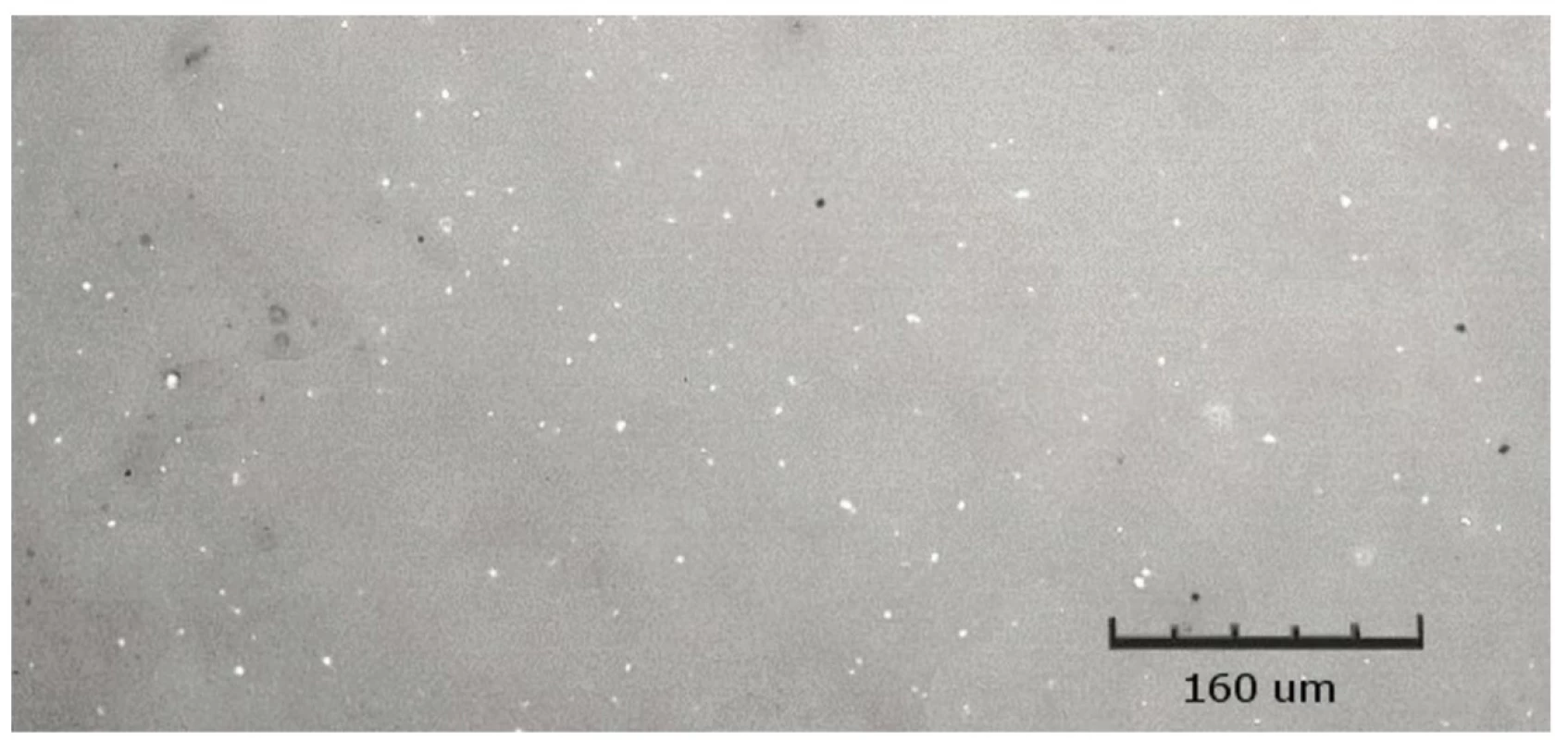 Kontrolní vzorek Filteku Ultimate Flow ve vodě, zobrazeno CLSM<br>
Fig. 15 Filtek Ultimate Flow control sample in water, shown by CLSM 