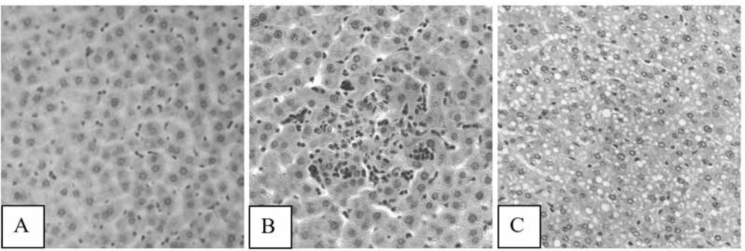 Photomicrographs of samples of liver tissues of intact control rats (A), rats treated with MTX (B,
C): a focus of hepatocyte necrosis (В) (× 250), vacuolar degeneration of hepatocytes (C) (HX&E × 200)