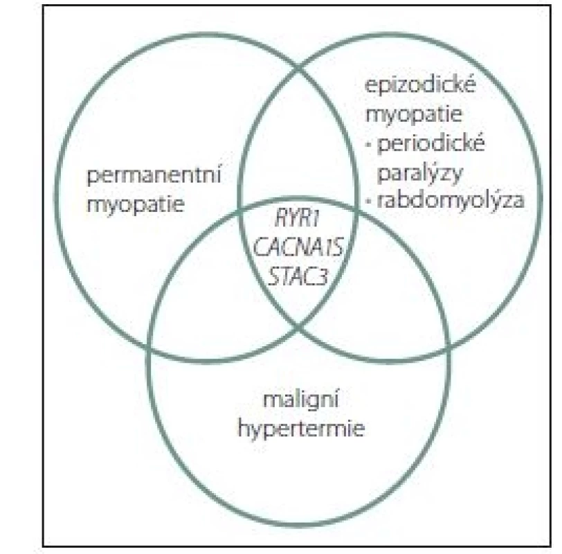 Klinické manifestace genových
mutací u svalových chorob, které se podílejí
na citlivosti k maligní hypertermii.<br>
Fig. 1. Clinical manifestations of gene mutations
in muscular diseases that contribute
to the sensitivity to malignant
hyperthermia.