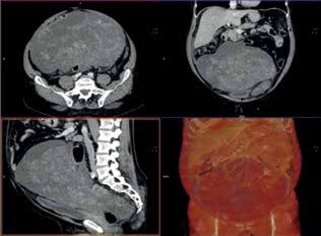 CTA vyšetření <br>
Fig. 4: CTA examination