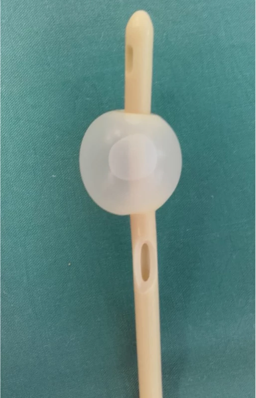 Permanentní močový katétr s arteficiálně
vytvořeným otvorem v úrovni pod balonkem<br>
Fig. 3. Permanent urinary catheter with arteficially
created opening under baloon