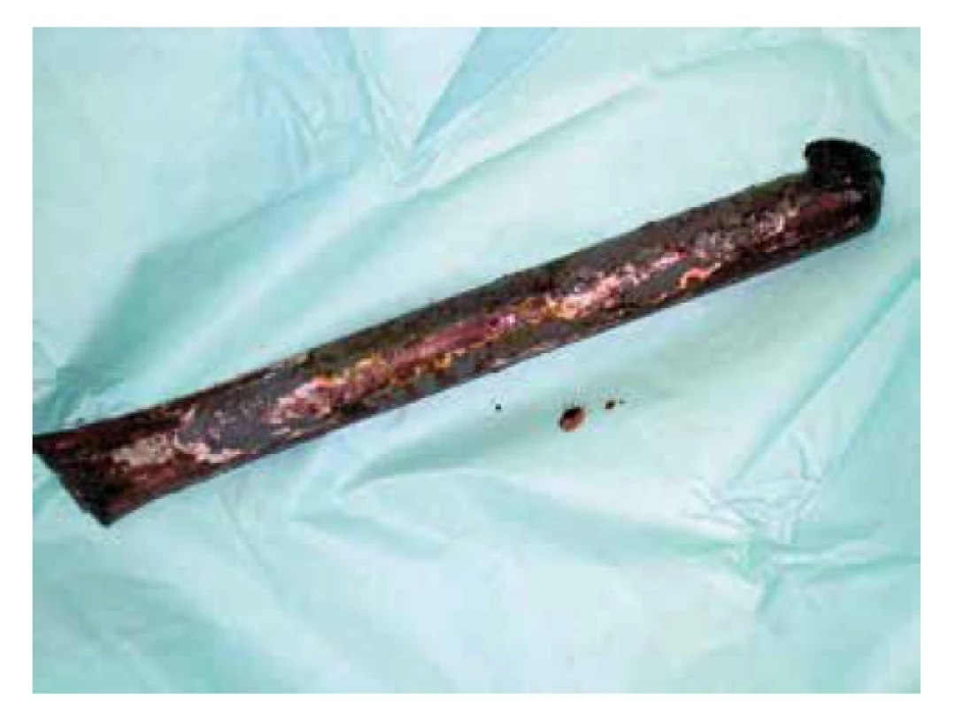 Tyč<br>
Fig. 4: The bar
