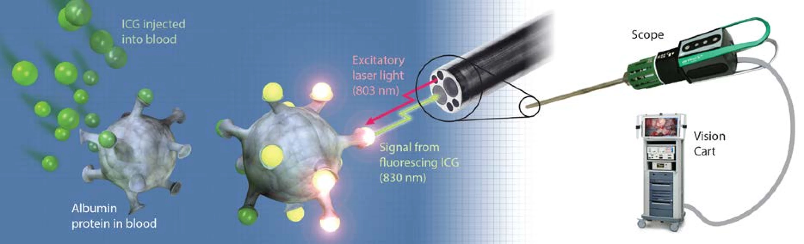 Princip fluorescence s využitím ICG<br>
Fig. 1. Concept of fluorescence with usage of ICG