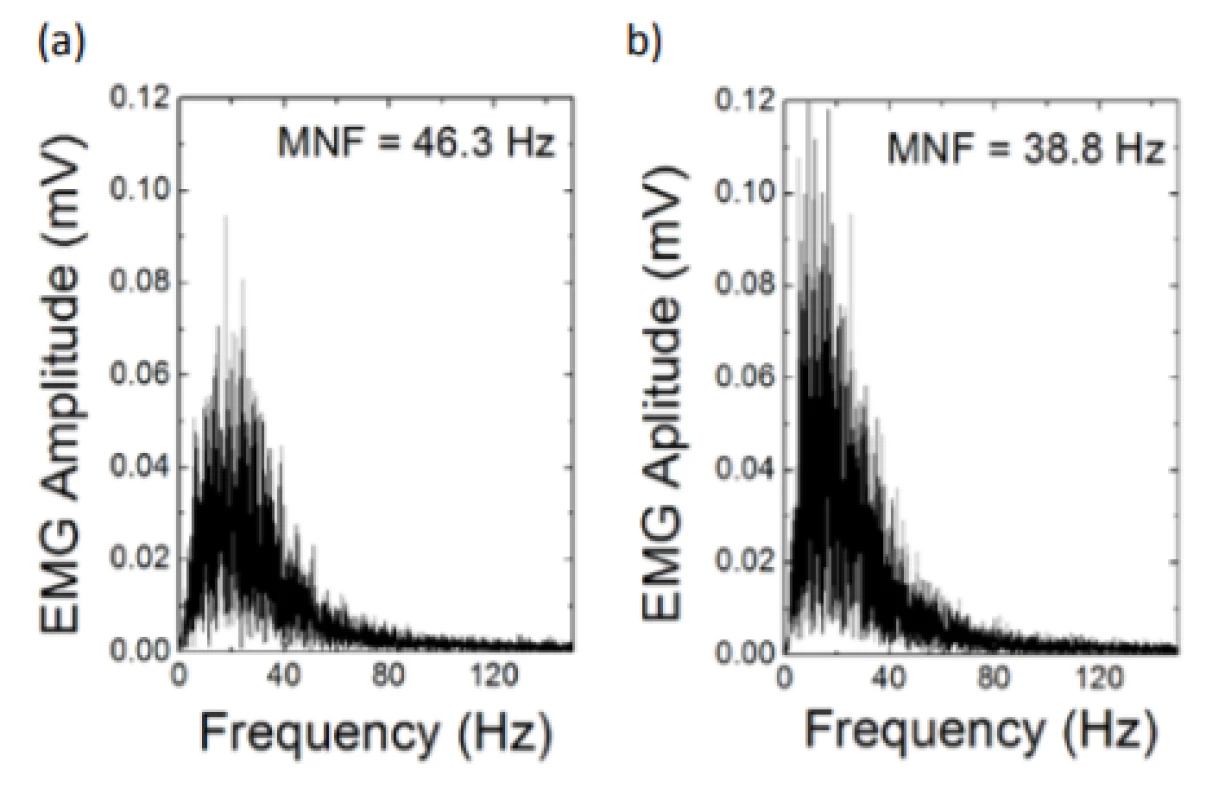 PSD – Holter isometric 50% MVC. (a)
Time = 0–15 s, (b) Time = 15–30 s. Amplitude and
mean frequency MNF shift of PSD due to fatigue factor.