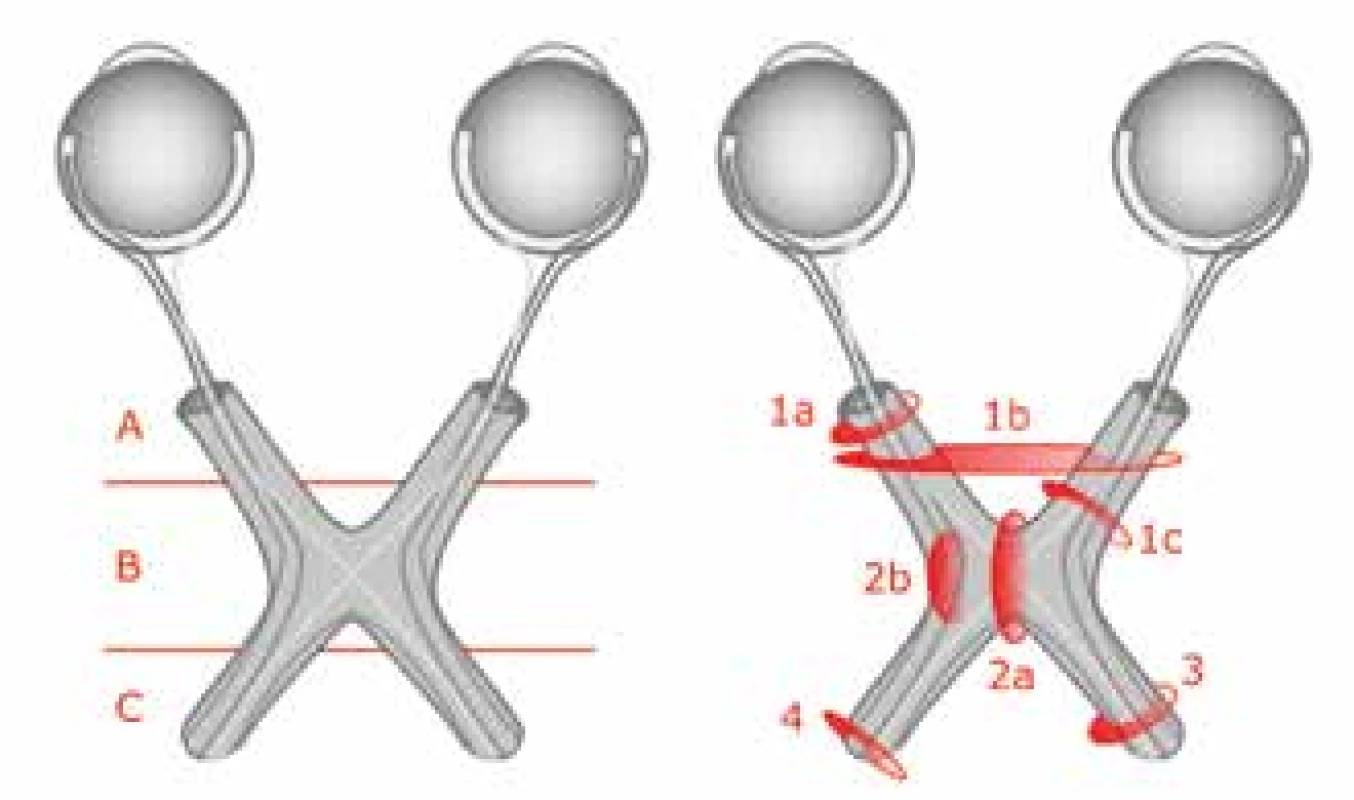 Original and modified Dodge classification<br>
Source: own illustration