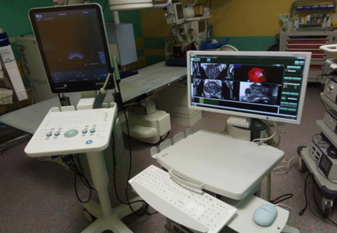 Ultrasonograf BK Flex Focus 800®™ vlevo; přístroj pro softwarovou fúzní biopsii Medcom®™ vpravo<br>
Fig. 4. Ultrasonography BK Flex Focus 800®™ on the left; software fusion guided biopsy device by Medcom®™
on the right
