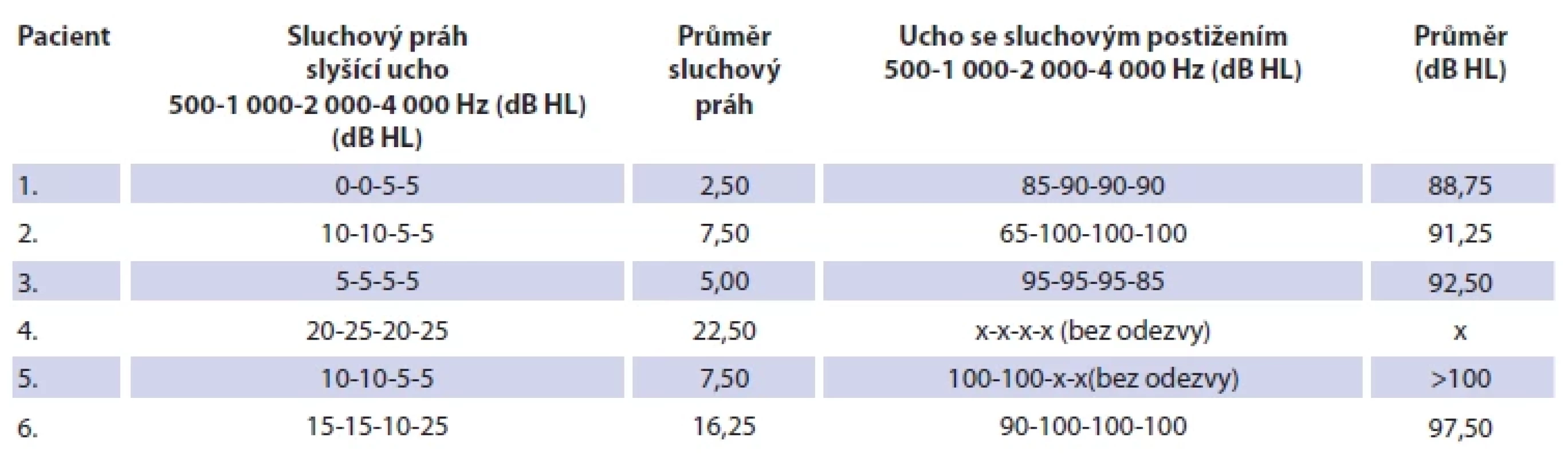 Výsledky audiometrického vyšetření před operací (pozn.: u pacienta 1 odhadovaný audiogram podle SSEP). <br> 
Tab. 2. Results of audiometric examination before surgery (note: in patient 1 estimated audiogram according to SSEP).