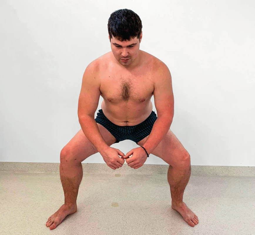 Boční squat - koaktivace m. quadriceps femoris
a hamstringy, m. gluteus medius, m. TFL, mm. gastrocnemií,
m. soleus.