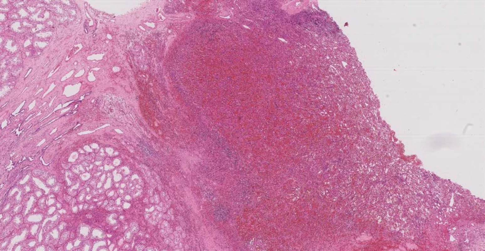 Detail histologického preparátu: zvětšeno 200x, barvení H&E<br>
Fig. 3. Detail of histological specimen: 200x magnification, dying H&E
