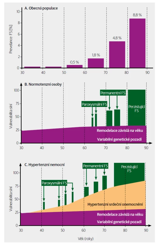 Predisponující faktory vzniku fibrilace síní: A. V obecné populaci se prevalence FS zvyšuje s věkem.
B. U normotenzních osob je vulnerabilita síní určována především genetickým pozadím a jejich
remodelací závislou na věku. Oba faktory přispívají ke spuštění FS, která se nejdříve objevuje jako paroxysmální,
potom permanentní a nakonec jako perzistující. C. Remodelace síní vyvolaná vysokým
krevním tlakem je nejdůležitějším faktorem predisponujícím ke vzniku FS u hypertenzních nemocných,
vedoucím k dřívějšímu nástupu paroxysmální FS a její přeměně na permanentní FS. [Upraveno podle
Wolf et al., 1991].